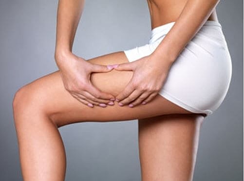 How Much Does Cellulite Reduction Cost?