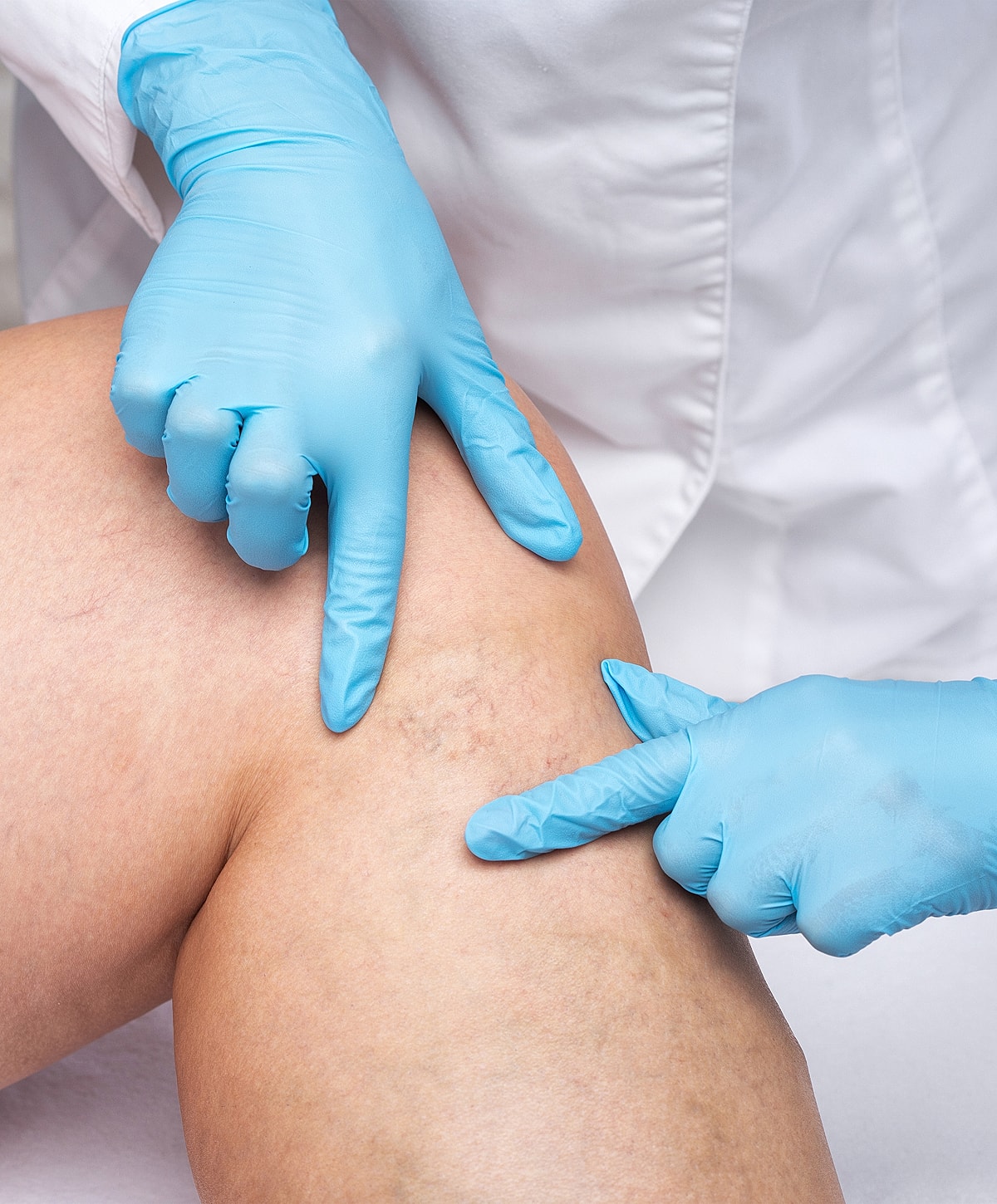 Close-up of a woman's face and smile.